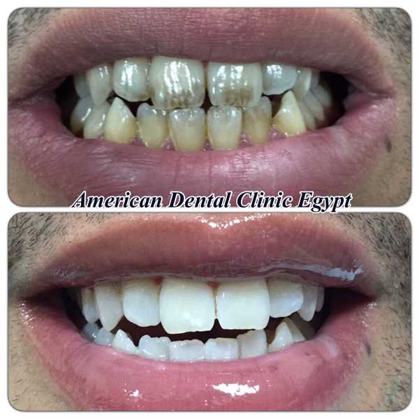 Clinic  American Dental Dr Ahmed Bakry